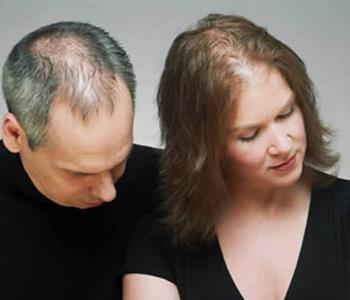 وصفات طبيعية لعلاج تساقط الشعر الوراثي