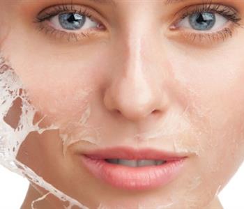 3 وصفات طبيعية لإزالة الشعر من الوجه في المنزل