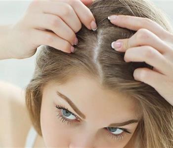 علاج القشرة في الشعر من أول مره