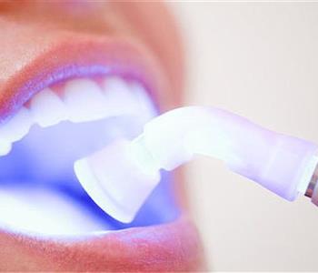 ما معنى تبييض الأسنان بالليزر وماهي فوائده وآثاره الجانبية