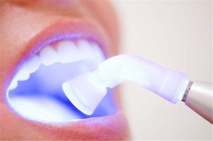 فوائد ومميزات تبييض الأسنان بالليزر