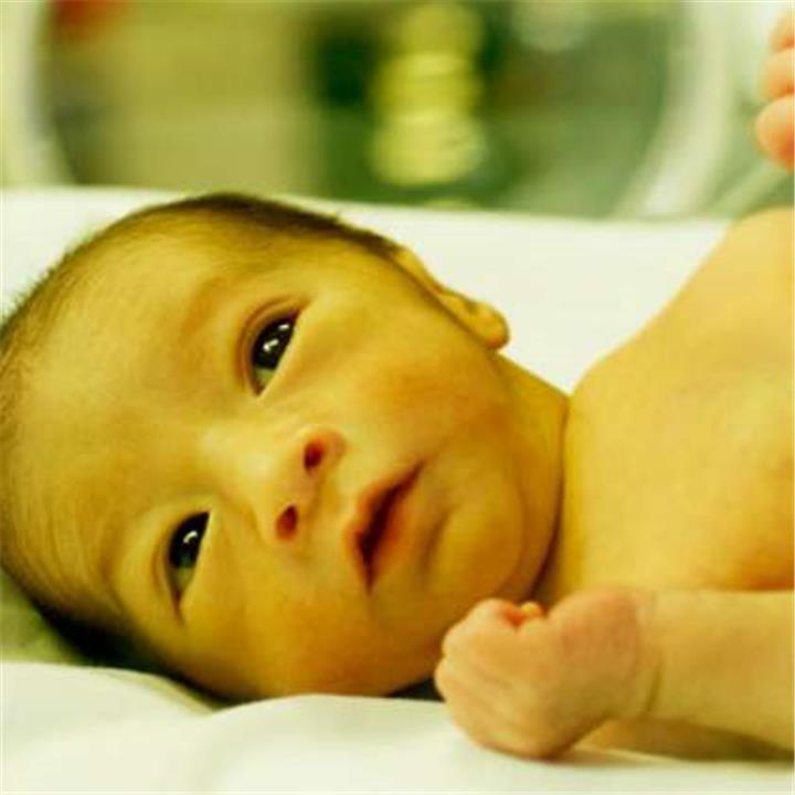طرق وقاية الطفل حديث الولادة من الإصابة بمرض الصفار