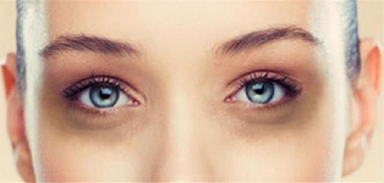 أهم أسباب ظهور الهالات السوداء حول العين