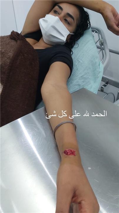 الصورة الأولى لإصابة الفنانة نانسي صلاح في انفجار بيروت