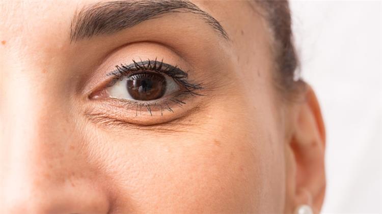 طرق طبيعية لمكافحة تجاعيد العين بدون استخدام البوتوكس