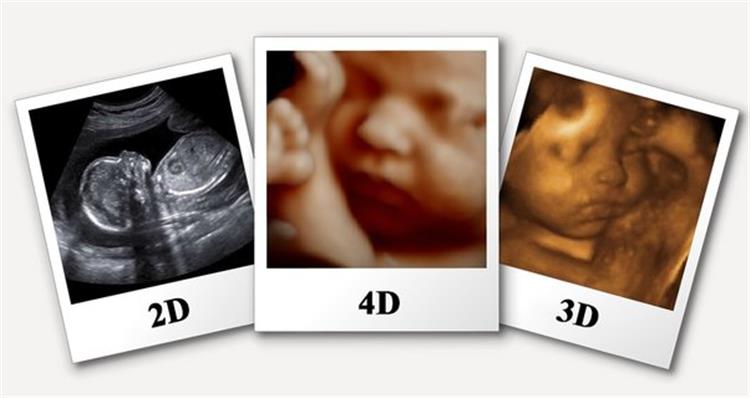 التوقيت المثالي للحامل لاجراء أشعة 4D