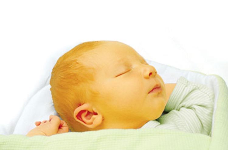 علاج الصفار عند الاطفال حديثى الولادة بالثوم