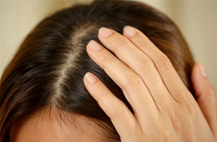 6 طرق طبيعية لتنظيف فروة الشعر