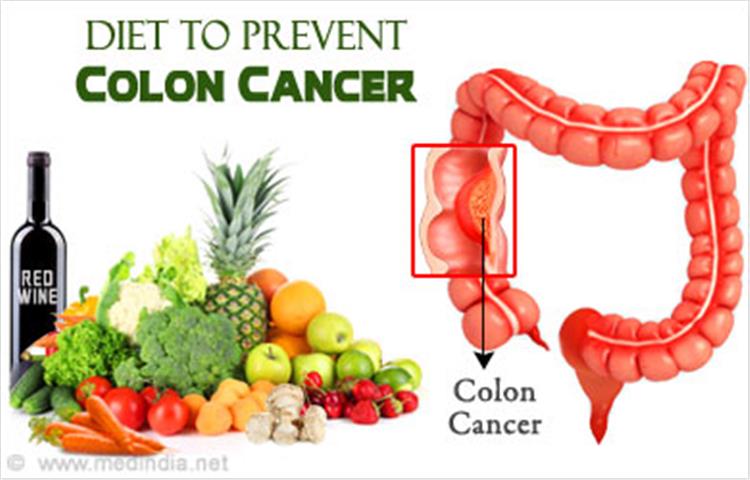 النظام الغذائي الصحي لمرضي سرطان القولون