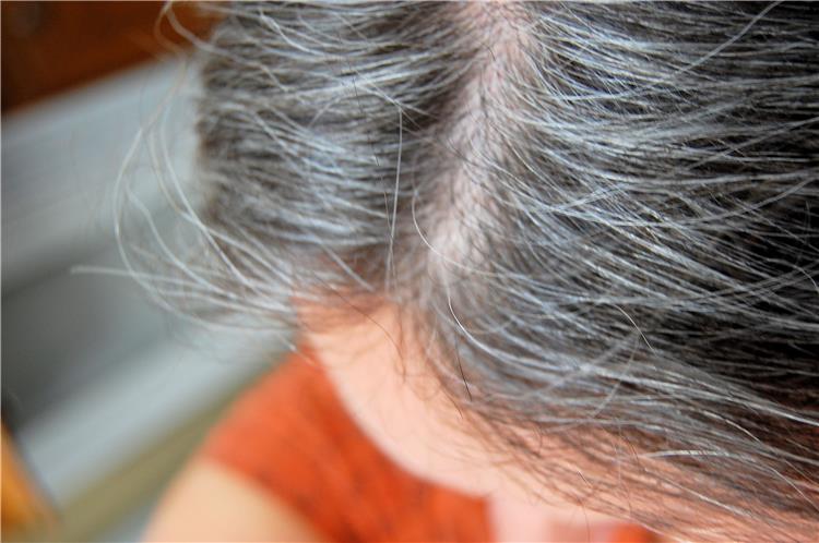 وصفات طبيعية للتخلص من الشعر الأبيض