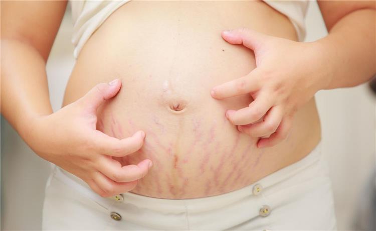 أسباب الحكة أثناء الحمل وطرق علاجها