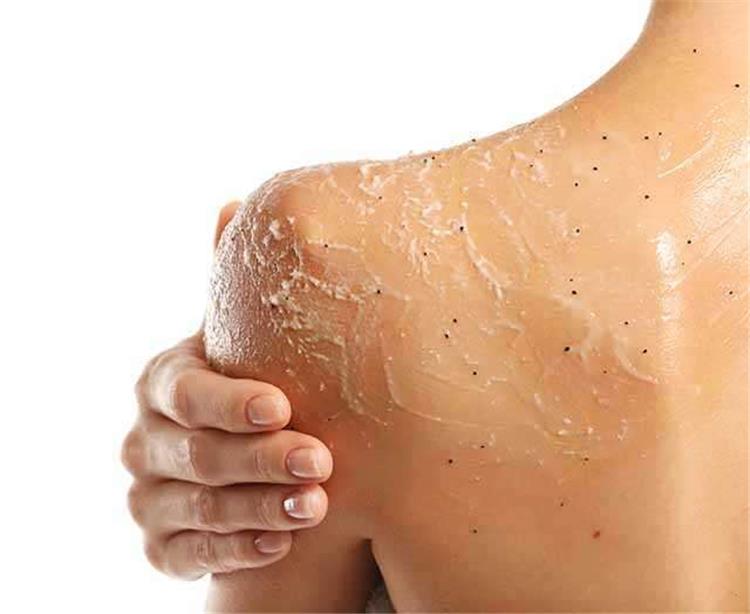 وصفات طبيعية للتخلص من الجلد الميت على الجسم