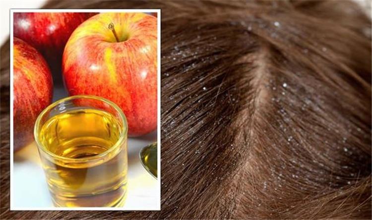 فوائد خل التفاح لتنظيف الشعر الدهني