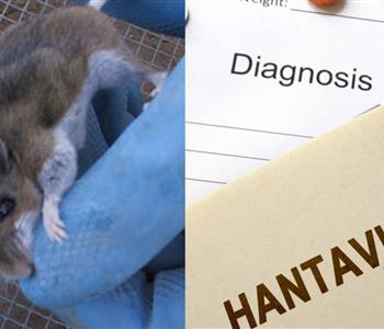بعد كورونا.. معلومات عن فيروس "هانتا" القاتل الذي ضرب الصين مؤخرًا