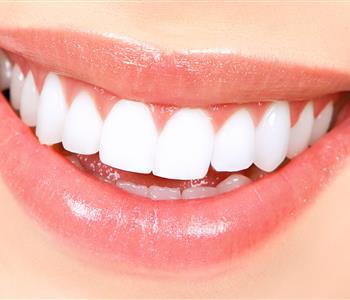 وصفات طبيعية لتبييض الاسنان تعرفي عليها