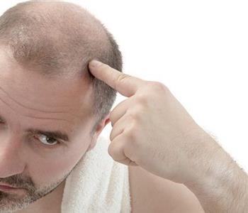 وصفات طبيعية لتساقط الشعر عند الرجال ومحاربة الصلع