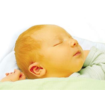 علاج الصفار عند الأطفال حديثي الولادة بالثوم