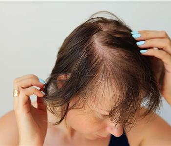 4 وصفات طبيعية لعلاج فراغات الشعر