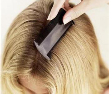 5 علاجات منزلية للتخلص من حشرات الشعر