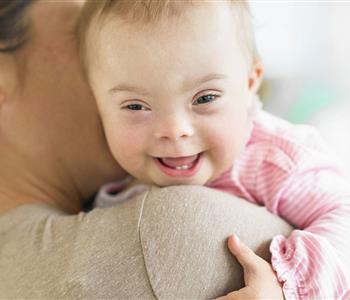 اعراض متلازمة داون عند الاطفال حديثي الولادة