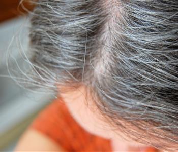 وصفات طبيعية للتخلص من الشعر الأبيض
